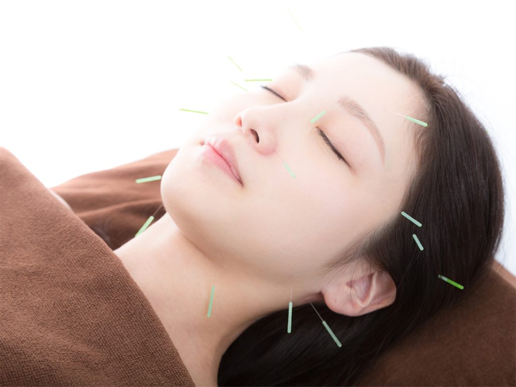 Facial Acupuncture