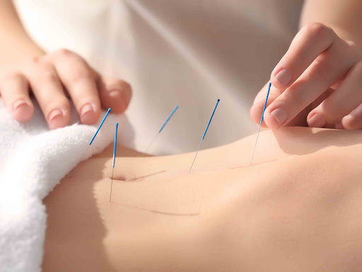 TCM Acupuncture Weight Loss Treatments