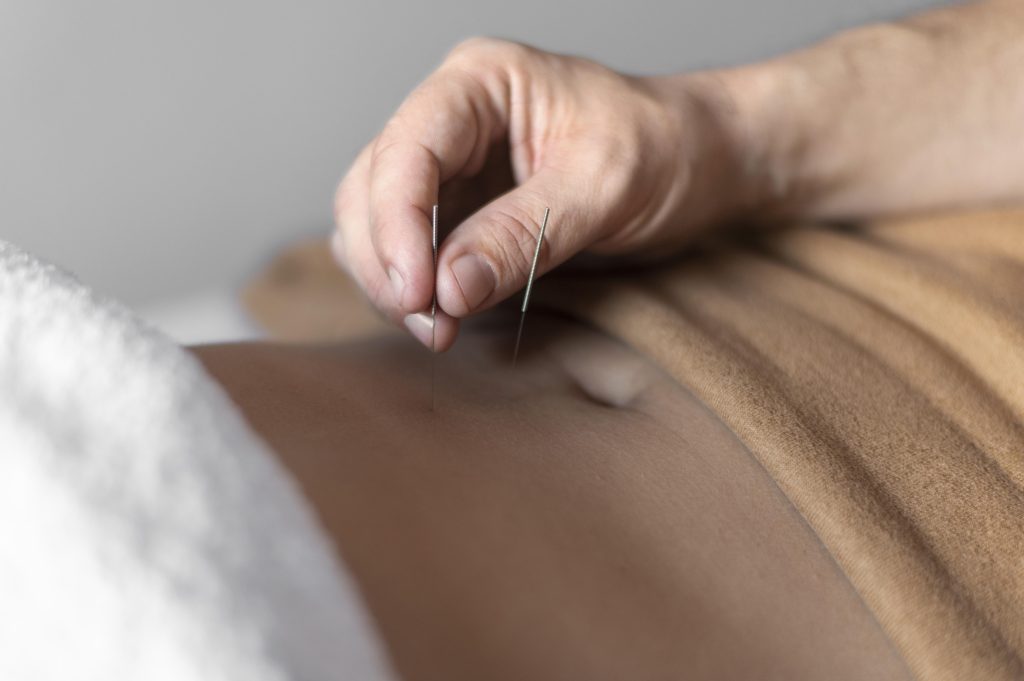 A Guide to Acupuncture Before and After Embryo Transfer